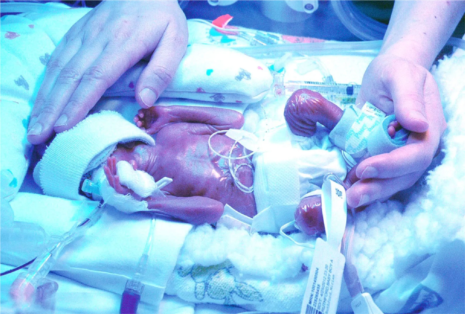 Premature babies at Gaza